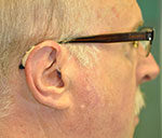 wearing glasses and hearing aids