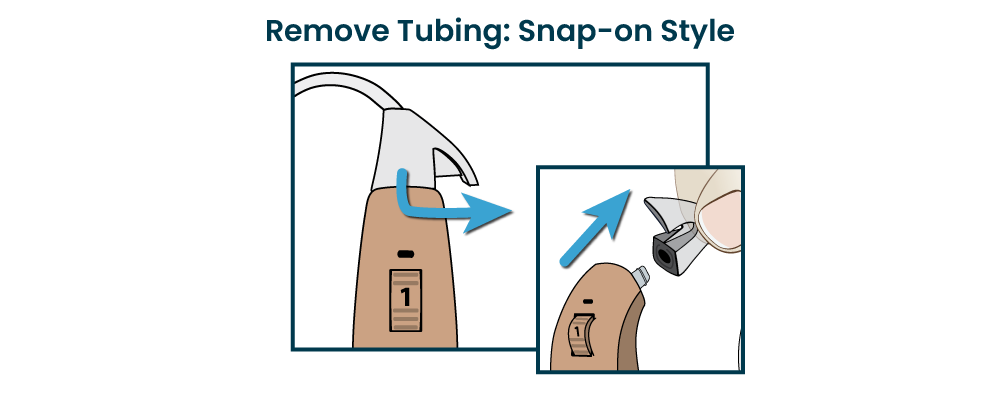 FAQ-RemoveTubing-SnapOn_0622.png